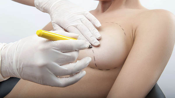 Docteur Robert Zerbib chirurgien Paris 16 75116 75016 Seins Reduction mammaire