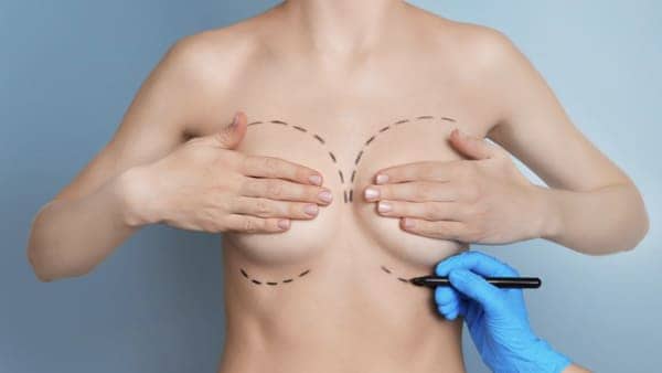 chirurgie esthetique des seins paris lifting des seins ptose mammaire lifting mammaire