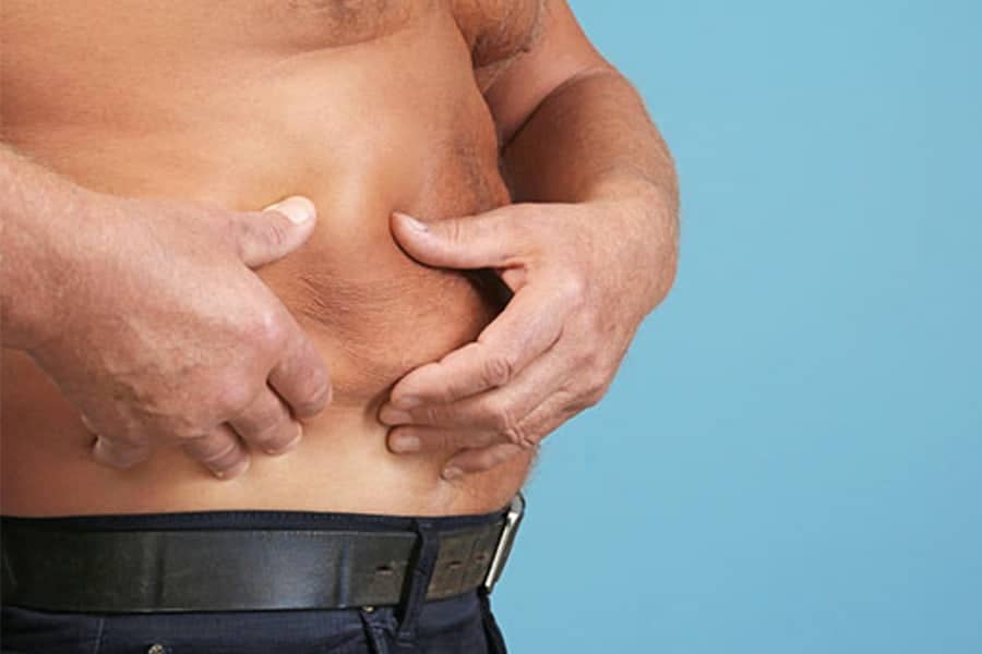 resultat abdominoplastie homme paris avant apres chirurgie esthetique ventre robert zerbib chirurgien esthetique paris
